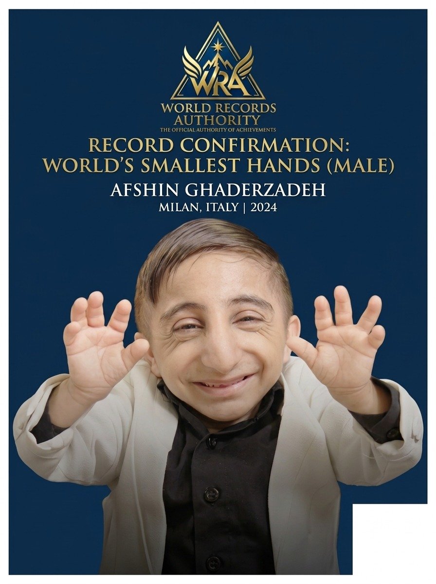 Afshin Ghaderzadeh — World's Smallest Hands